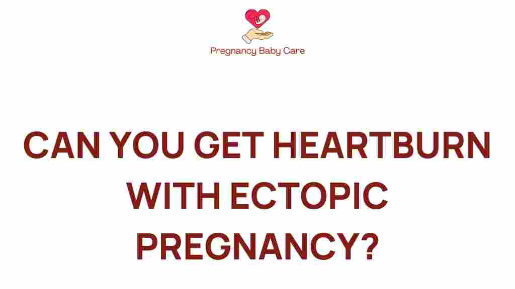 heartburn-ectopic-pregnancy