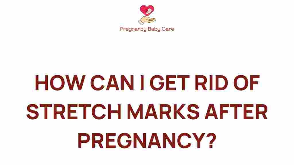 stretch-marks-reduction-post-pregnancy