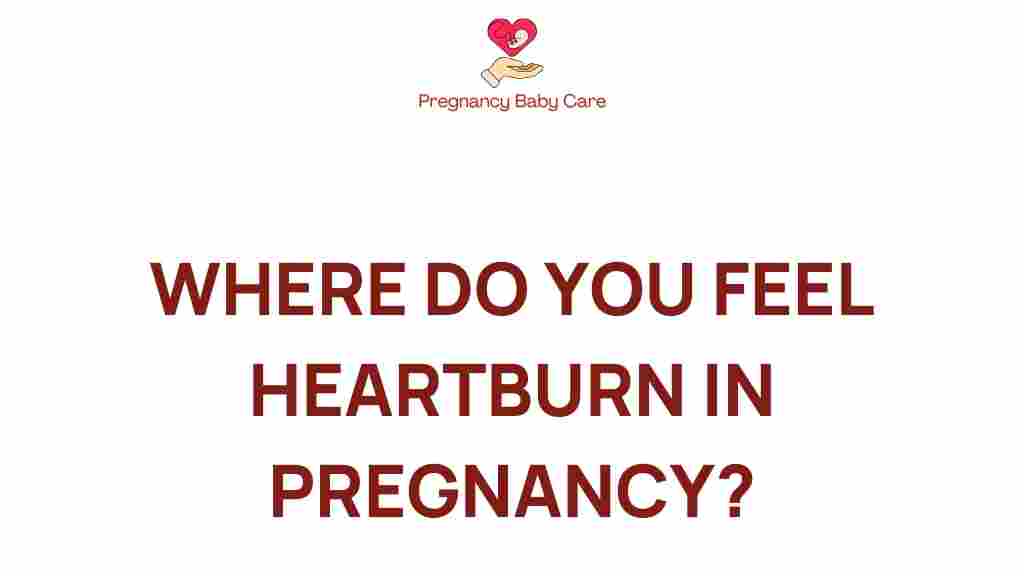 heartburn-in-pregnancy