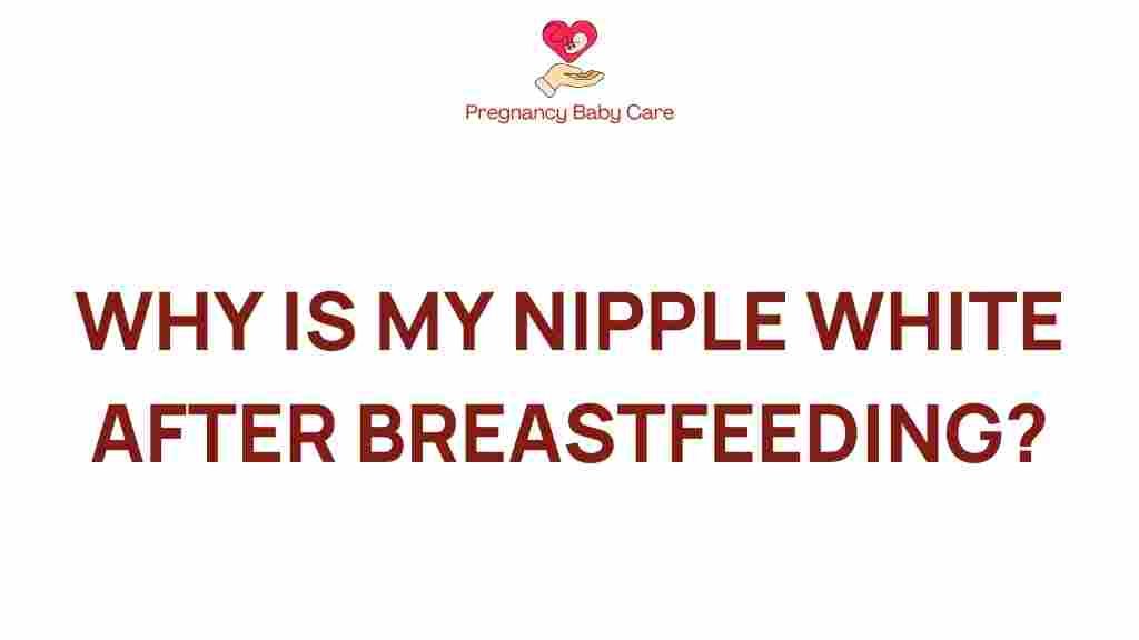 white-nipples-breastfeeding