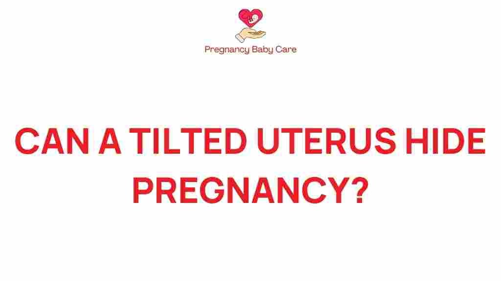 tilted-uterus-conceal-pregnancy