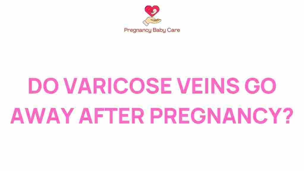 varicose-veins-pregnancy